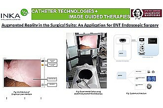 Detailbild zu :  Augmented Reality in the Surgical Suite: An Application for ENT Endoscopic Surgery